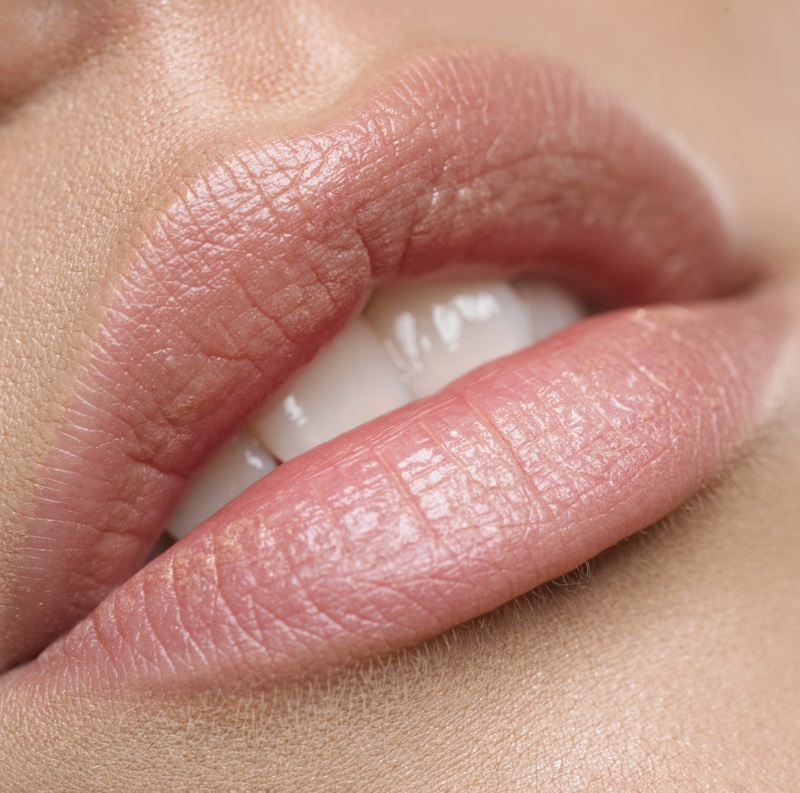 relleno-labial