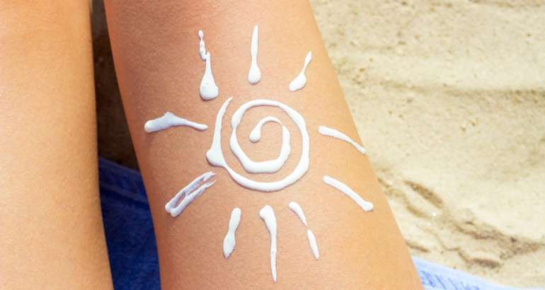 REMEDIOS PARA LAS QUEMADURAS SOLARES