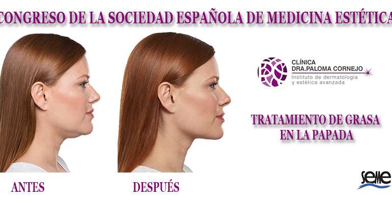 Congreso de la Sociedad Española de Medicina Estética
