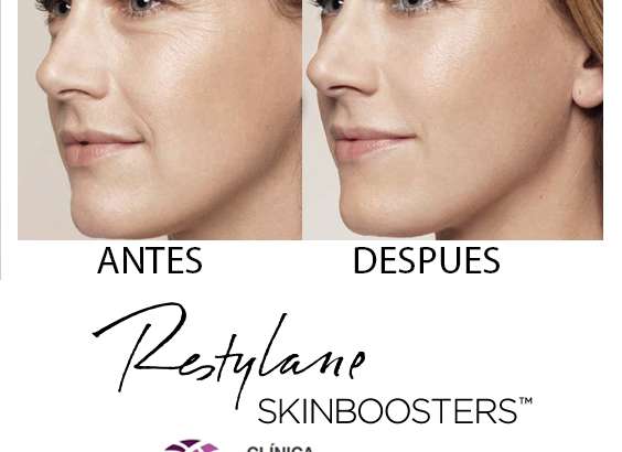 Algo más que una mesoterapia