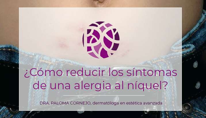 ¿Tienes alergia al níquel? Te cuento como reducir los síntomas