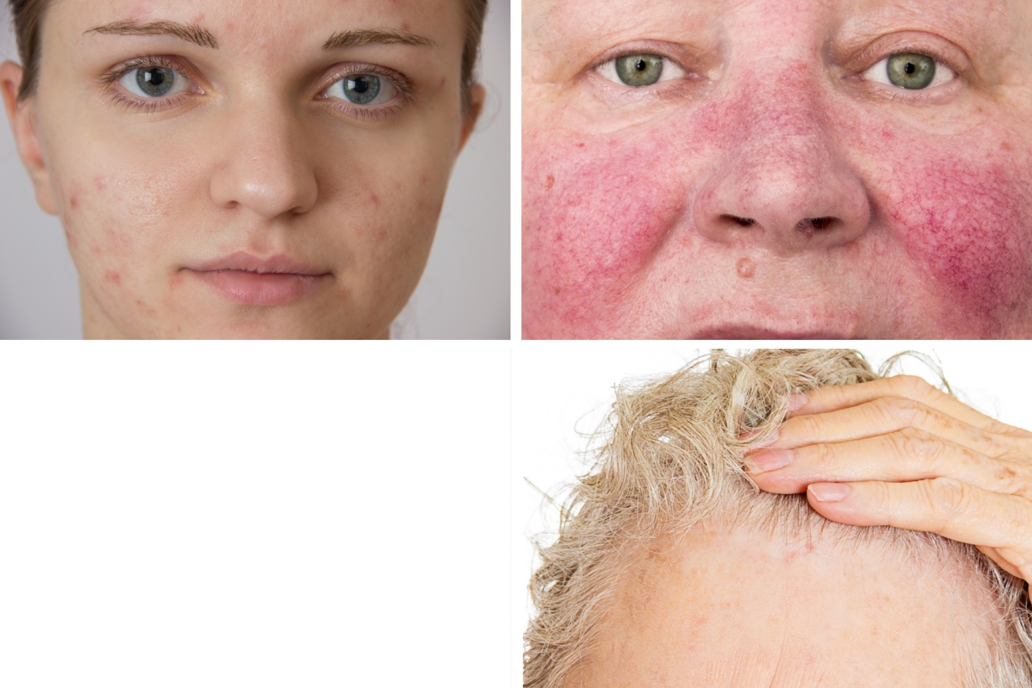 4 de las ultimas novedades en tratamientos dermatológicos