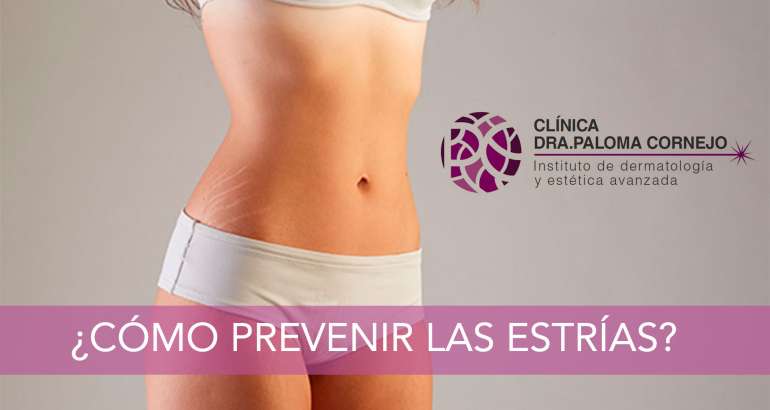 ¿Cómo prevenir las tan temidas estrías?
