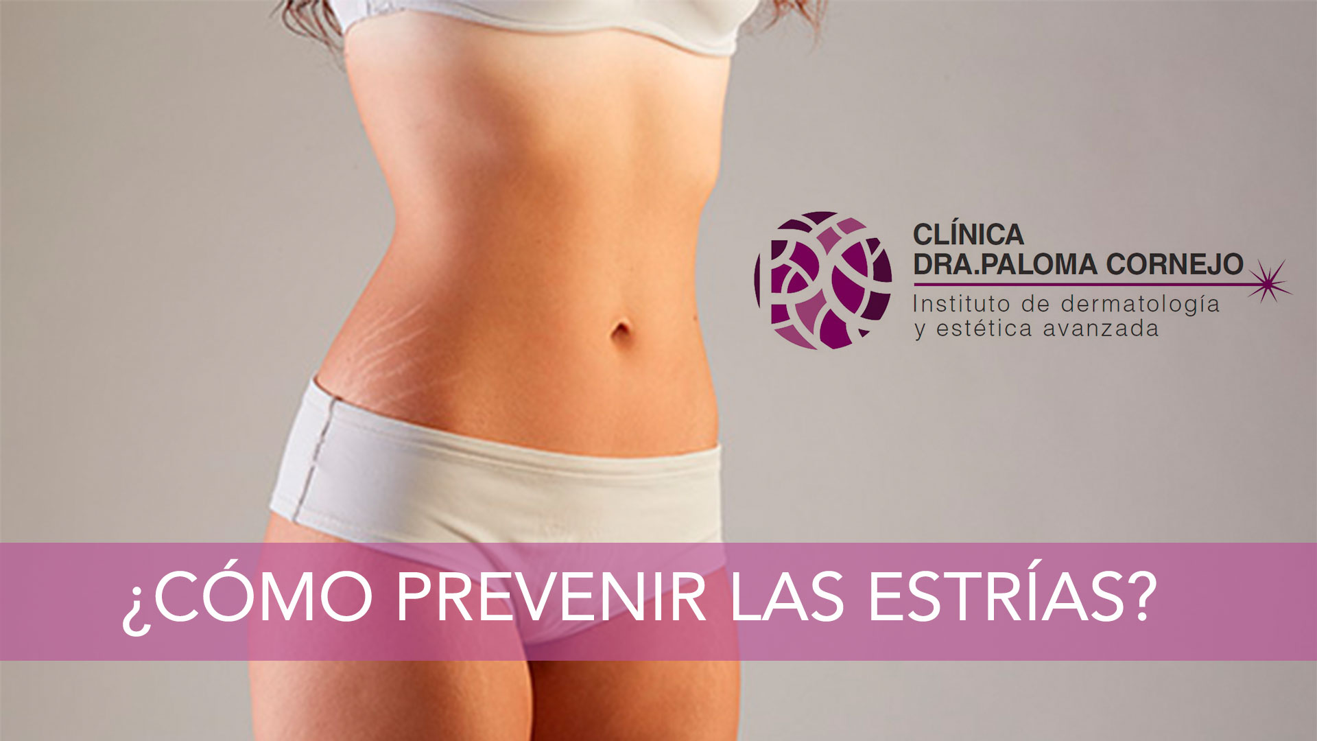 ¿Cómo prevenir las tan temidas estrías?