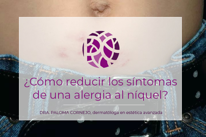 Tienes alergia al níquel? Te cuento como reducir los síntomas Paloma Cornejo