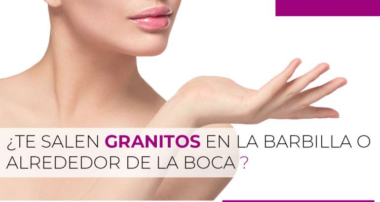 ¿Te salen granitos solo en la barbilla o alrededor de la boca?