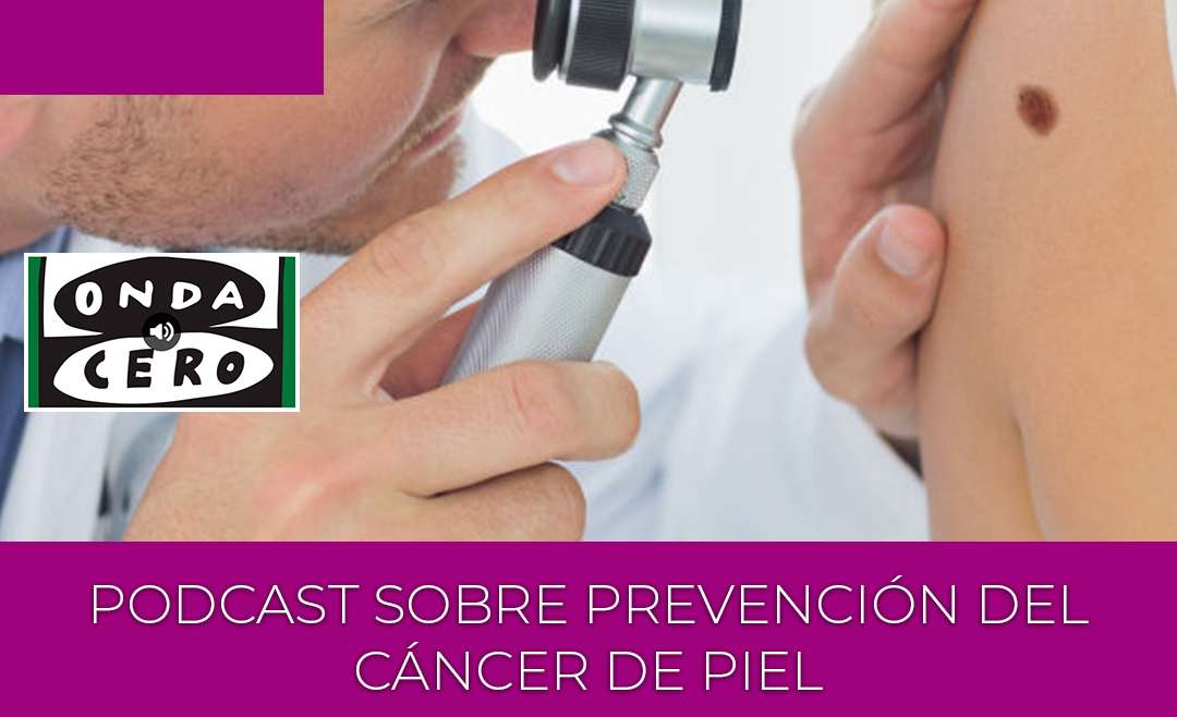 Día Europeo de la Prevención del Cáncer de Piel