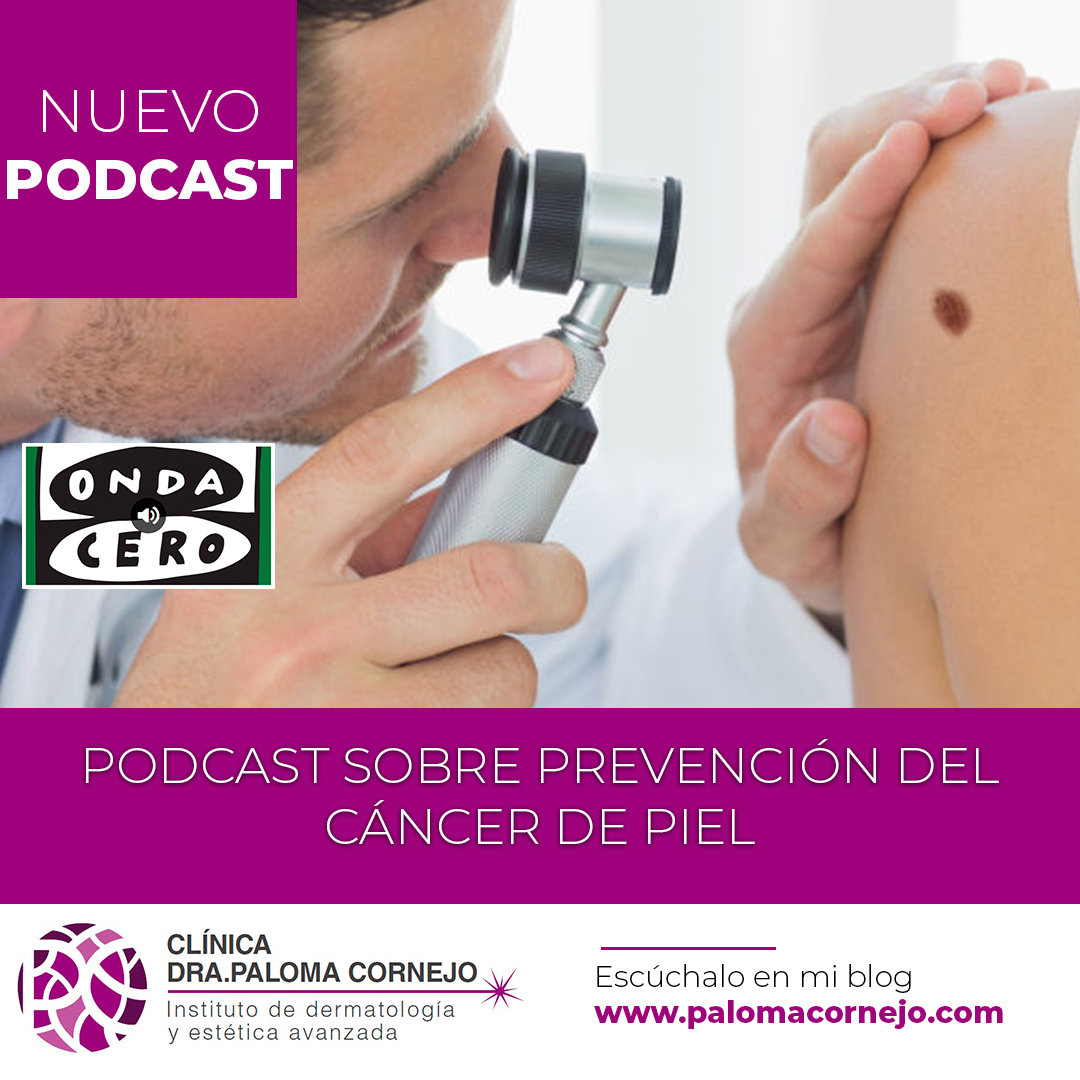 Día Europeo de la Prevención del Cáncer de Piel