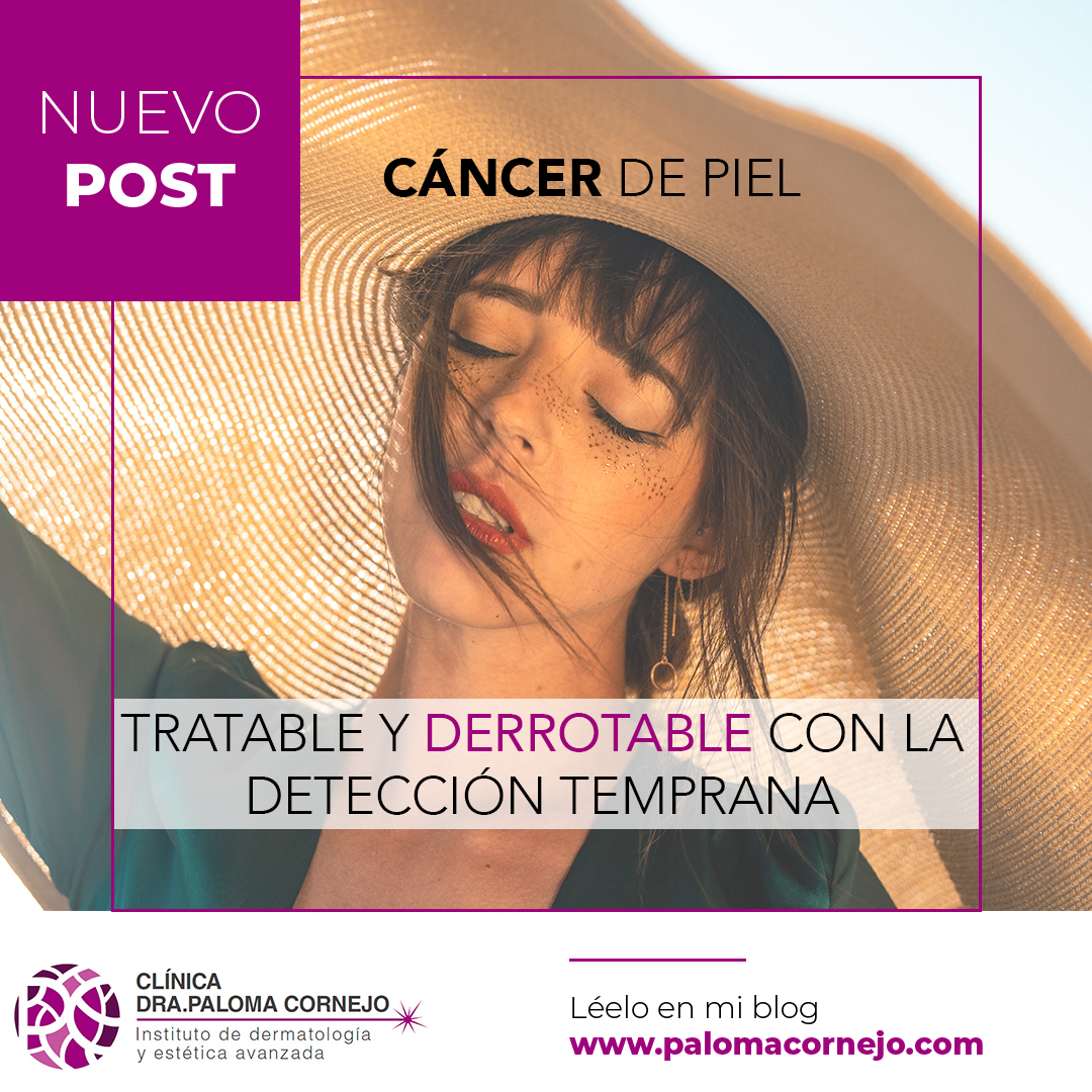 Cáncer de Piel: Tratable y Derrotable con la Detección Temprana