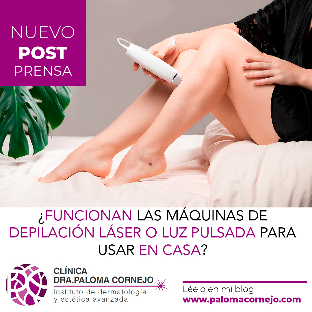 Funcionan las máquinas de depilación láser o luz pulsada para usar en casa?  – Paloma Cornejo – Más que derma