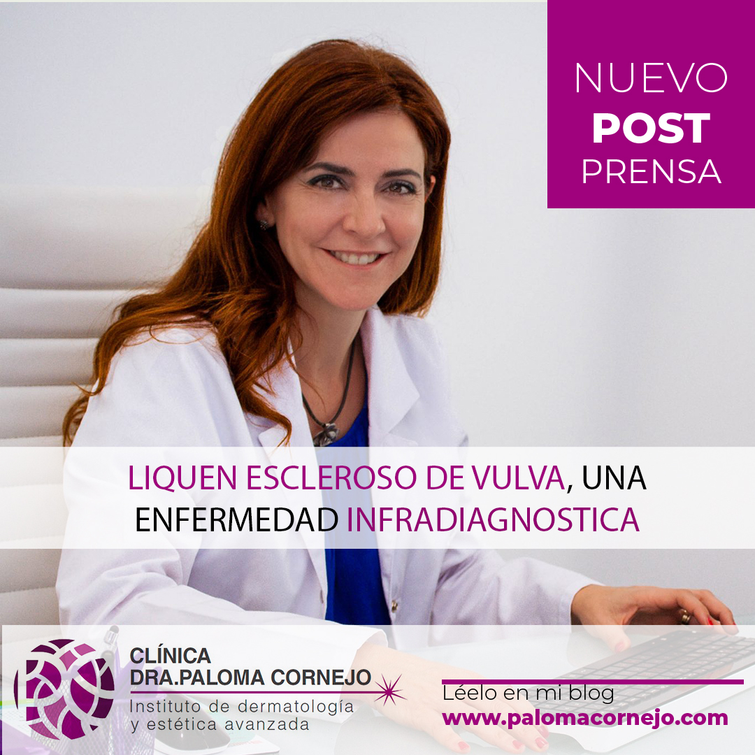 Funcionan las máquinas de depilación láser o luz pulsada para usar en casa?  – Paloma Cornejo – Más que derma